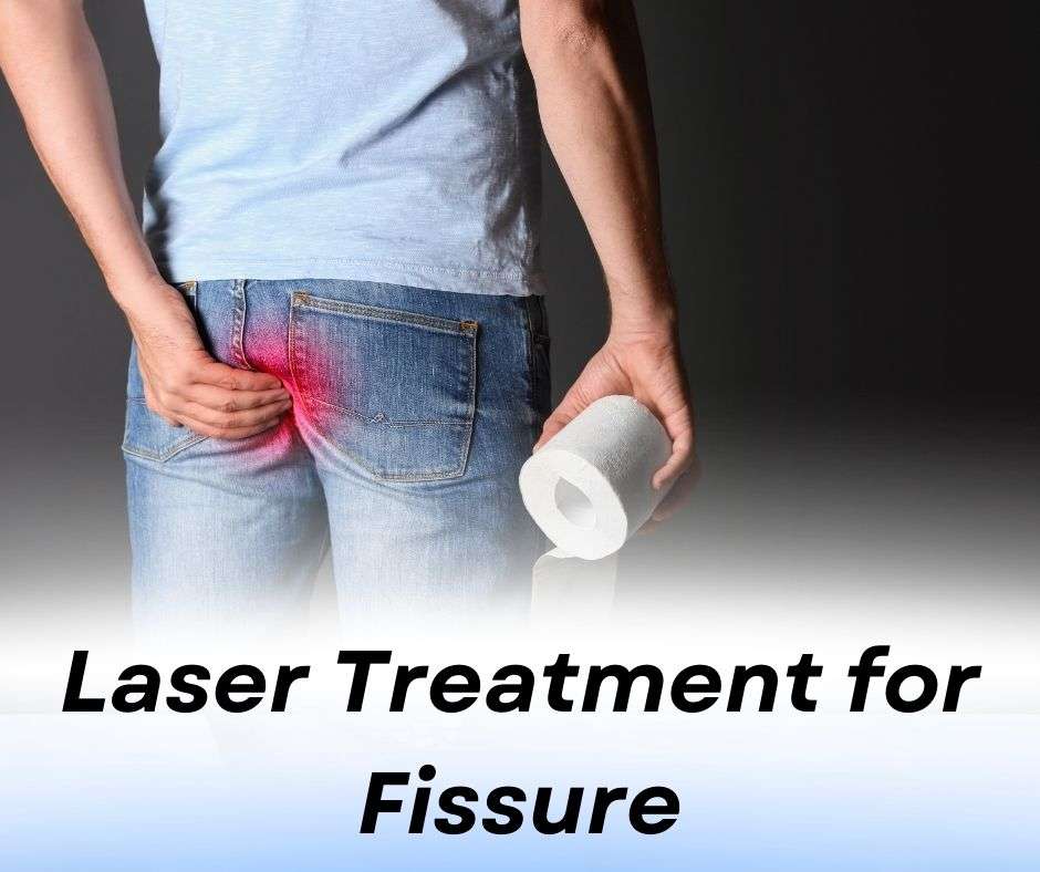 Laser Treatment for Fissure