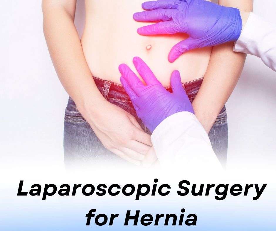 Laparoscopic Surgery for Hernia